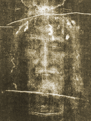 The face on the Turin Shroud